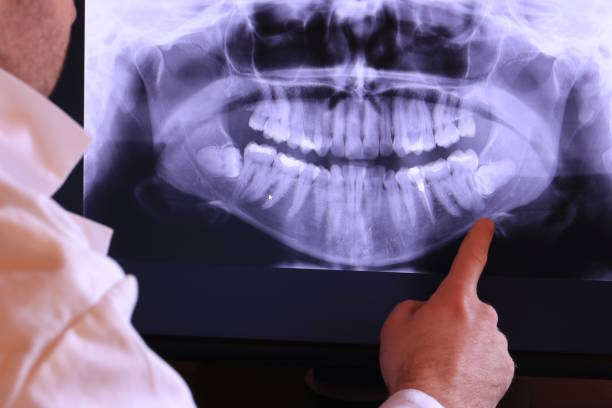 Best Emergency Treatment for Toothache in Shamokin, PA