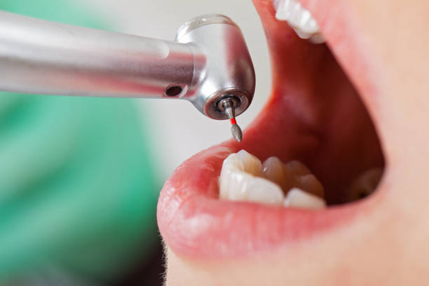 Best Emergency Treatment for Toothache in Shamokin, PA